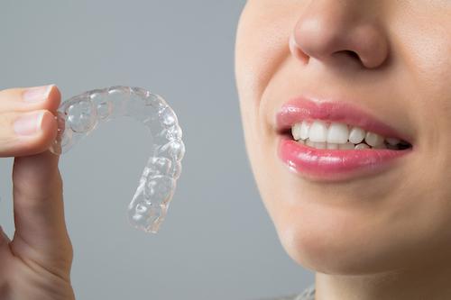 Invisalign in Avondale, NZ