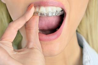 A woman putting on an invisible veneer in Auckland