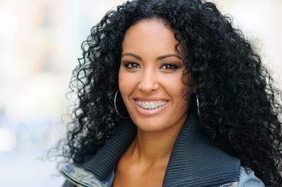 woman with curly hair smiling | invisalign west auckland
