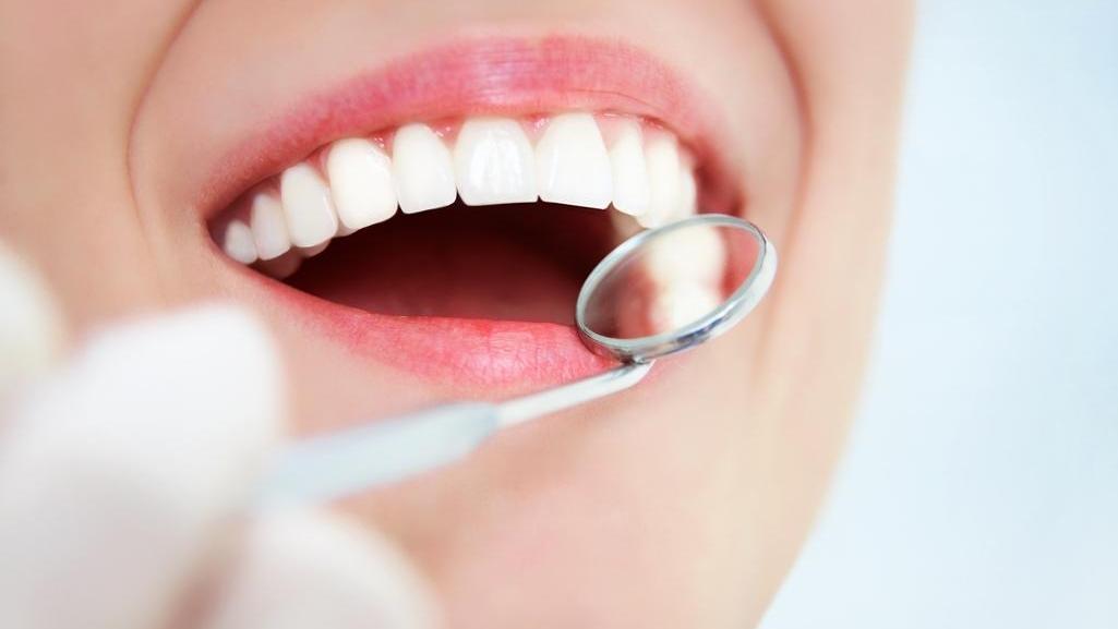 What To Expect At A Teeth Cleaning Avondale Dental Centre