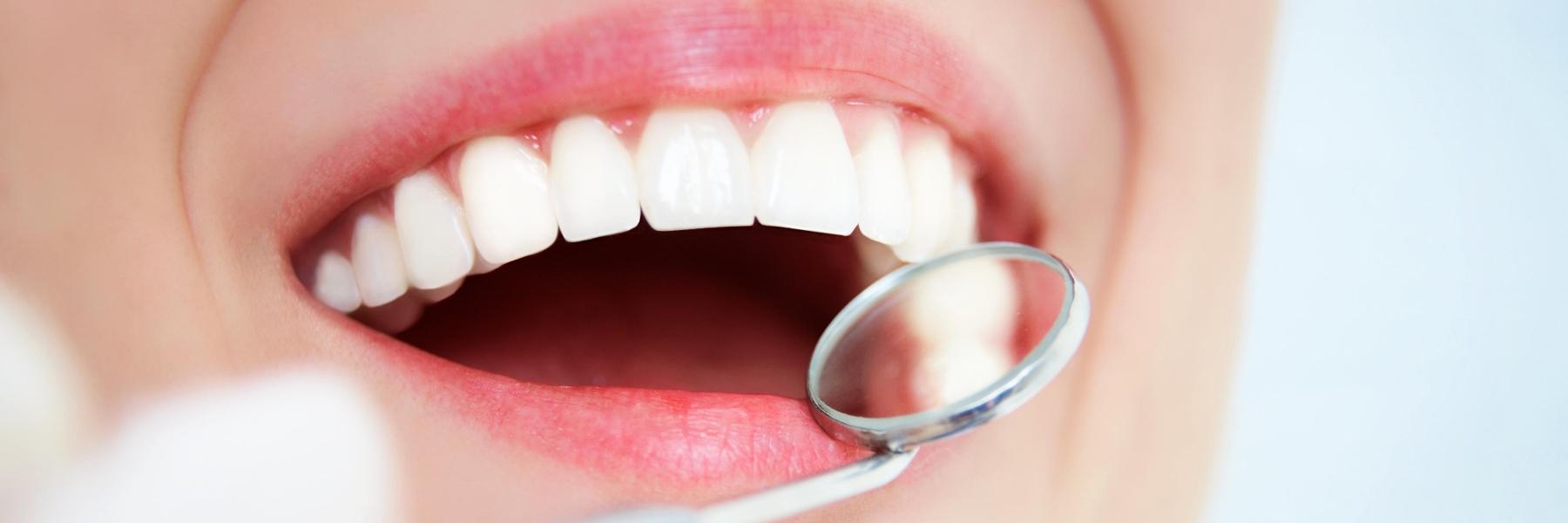 Woman | Avondale Dental Centre