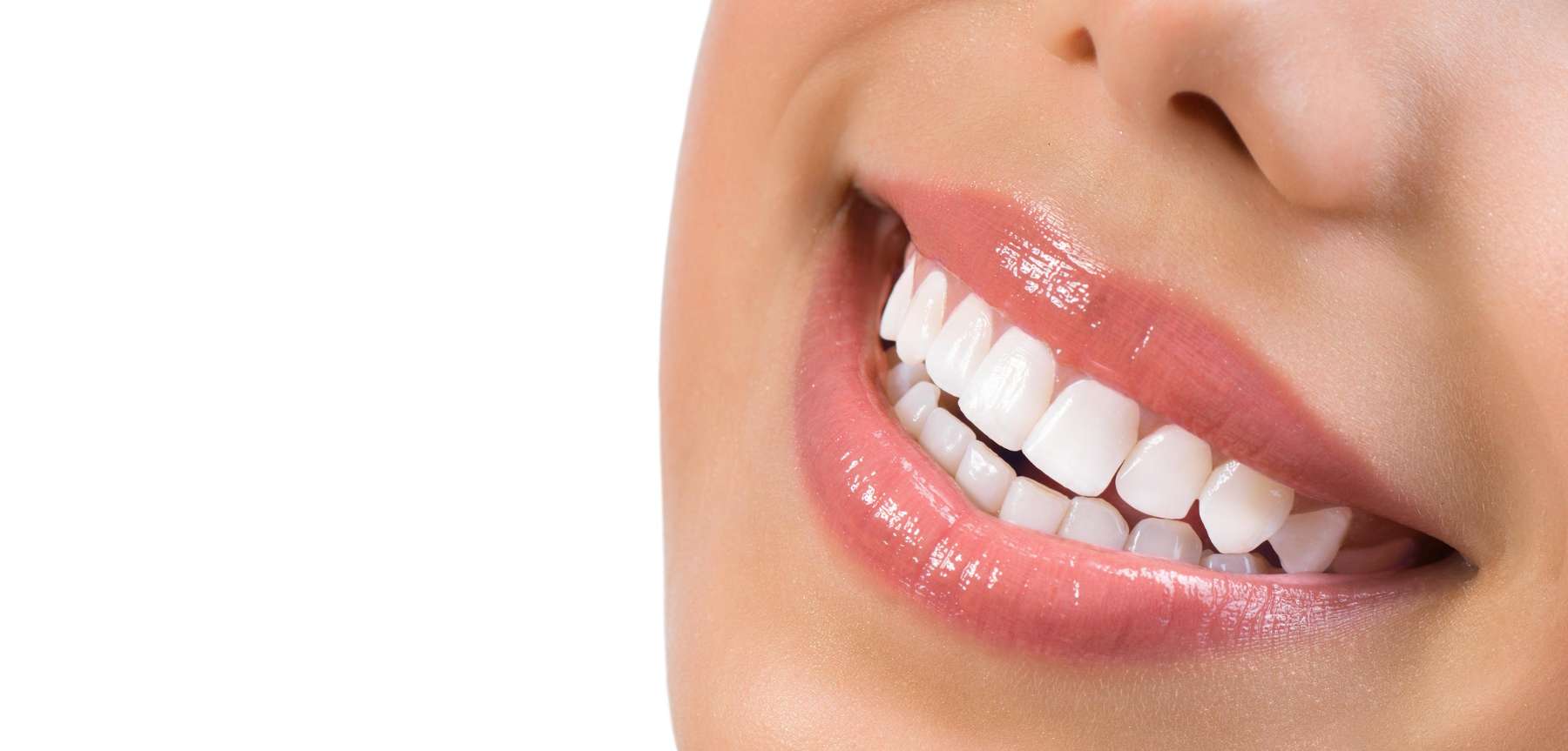 A image depicting a smile of a woman after a cosmetic dentistry in Auckland, Avondale