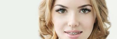 girl with braces in new lynn