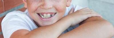 A picture of a child smiling with braces in Avondale Dental Centre