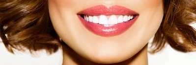 woman smiling with straight teeth | dentist implants west auckland