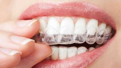 A picture of a lady holding invisalign in Avondale Dental Centre