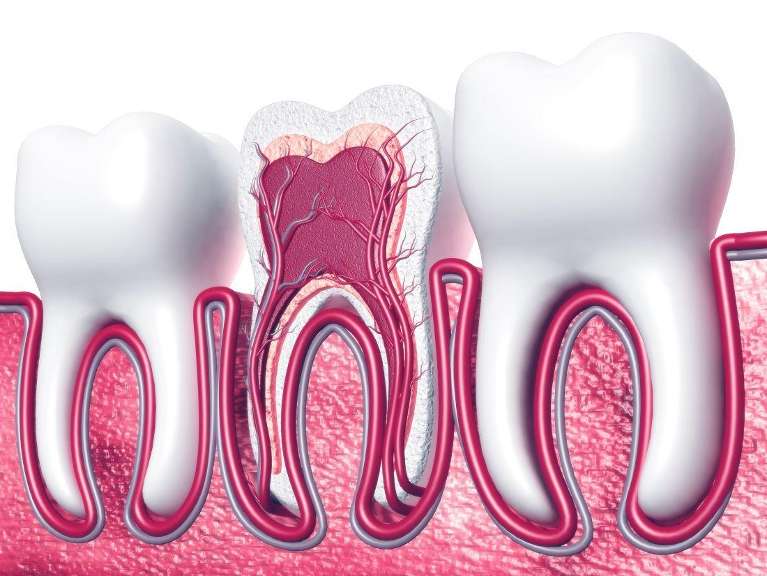 A graphic image depicting a teeth roots in Avondale, Auckland