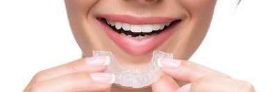 patient putting in clear plastic aligner | invisalign west auckland